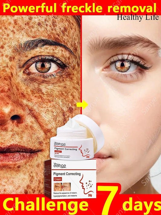 Dark Spots Remover Whitening Cream Niacinamide Powerful Removal Melasma Emulsion Women Freckles Brighten Cream Korean Skin Care