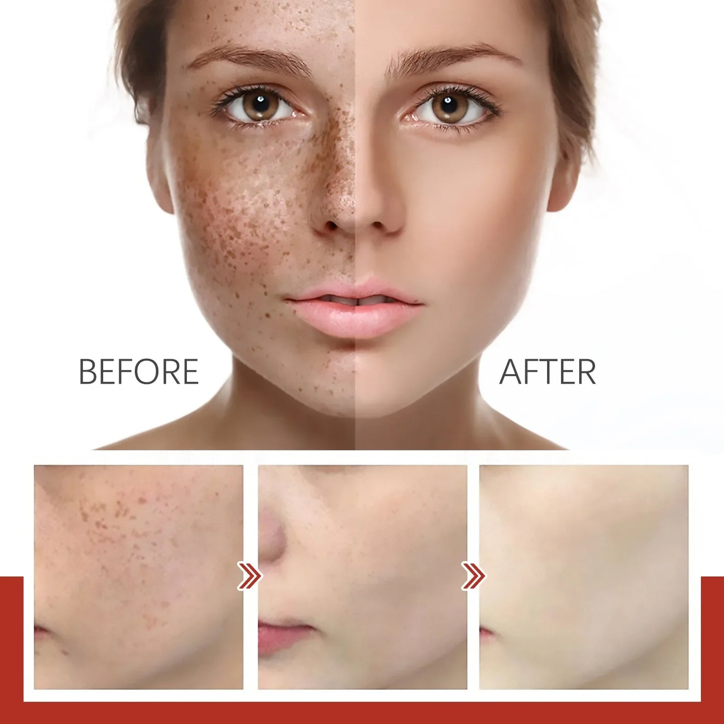 Dark Spots Remover Whitening Cream Niacinamide Powerful Removal Melasma Emulsion Women Freckles Brighten Cream Korean Skin Care