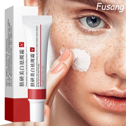 Face Chloasma Removal Cream For Women Remove Melasma Brighten Cream Facial Fade Dull Brightening Cream Dark Skin Lightening Care