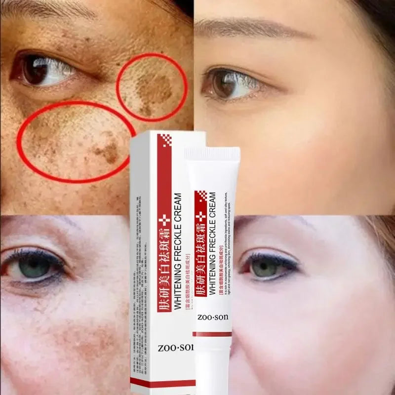 Face Melasma Cream Brighten Dark Skin Emulsion Lightening Melanin Brighten Cream For Dull Skin Women Moisturizing Products New