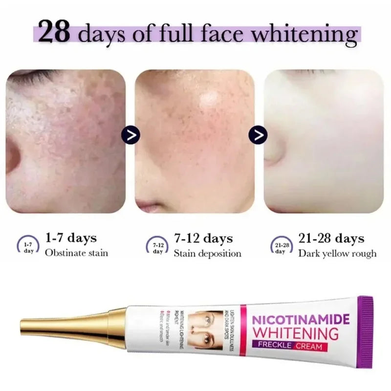 Face Melasma Cream Brightening Dark Skin Emulsion Lightening Melanin Brighten Cream for Dull Skin Women Moisturizing Products