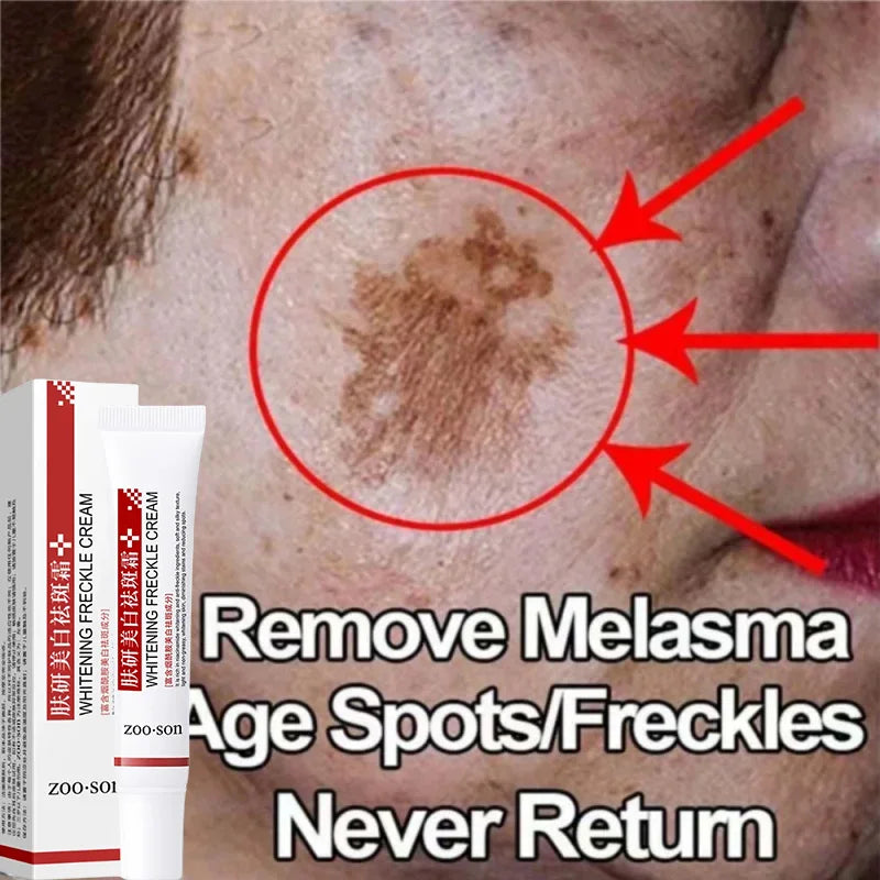 Face Melasma Cream Brighten Dark Skin Emulsion Lightening Melanin Brighten Cream For Dull Skin Women Moisturizing Products New