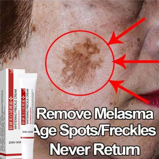 Face Melasma Cream Brighten Dark Skin Emulsion Lightening Melanin Brighten Cream For Dull Skin Women Moisturizing Products New