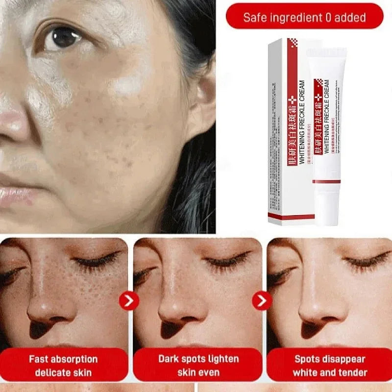 Face Melasma Cream Brighten Dark Skin Emulsion Lightening Melanin Brighten Cream For Dull Skin Women Moisturizing Products New