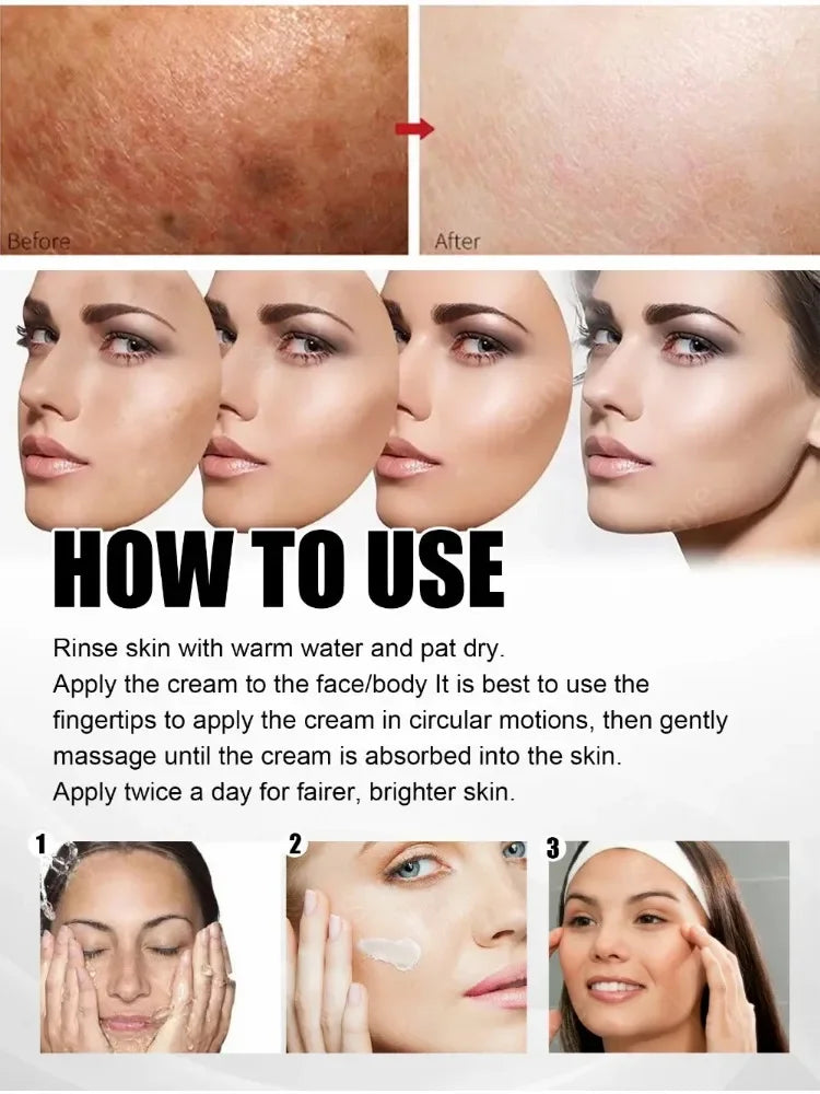 Face Chloasma Removal Cream For Women Remove Melasma Brighten Cream Facial Fade Dull Brightening Cream Dark Skin Lightening Care